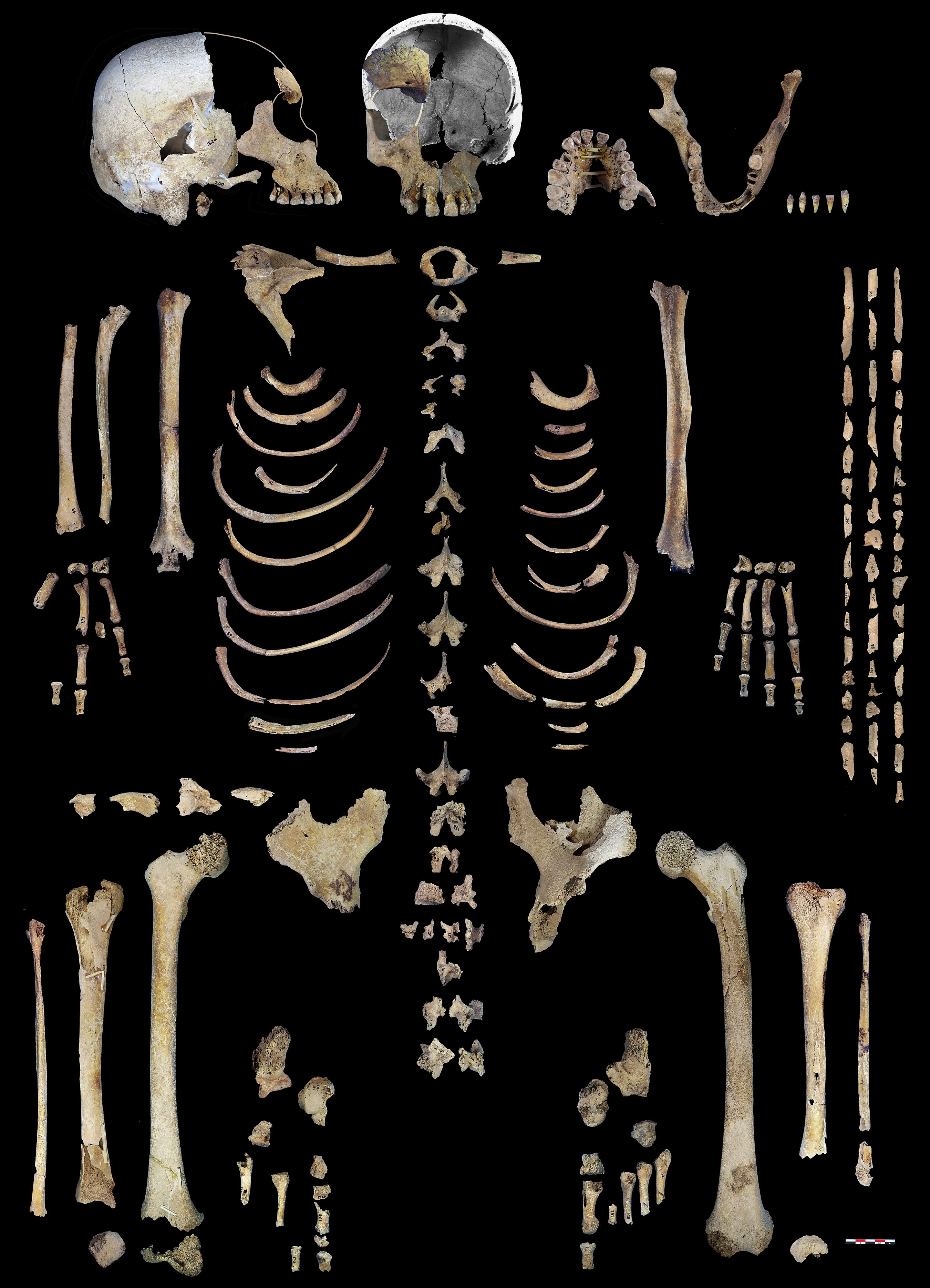 partes esqueletarias en posicion anatomica